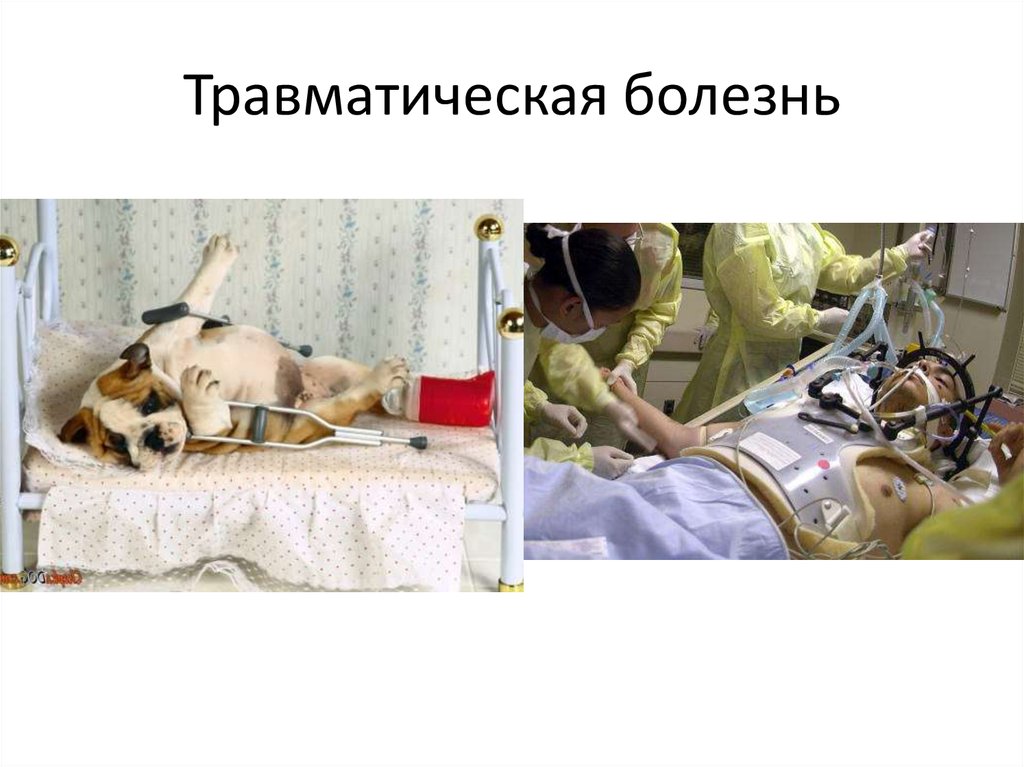 Травматическая болезнь