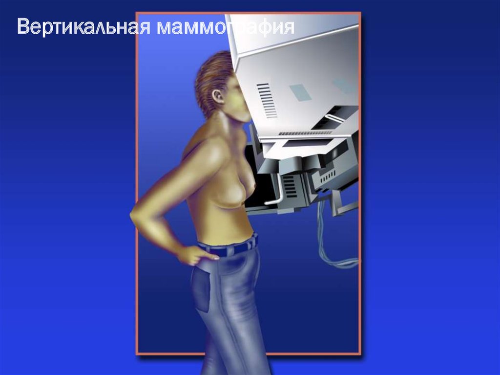 Вертикальная маммография