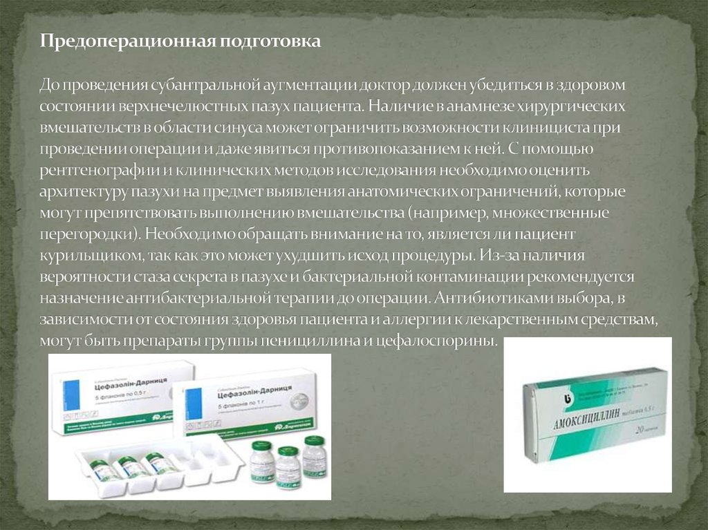 Предоперационная подготовка До проведения субантральной аугментации доктор должен убедиться в здоровом состоянии