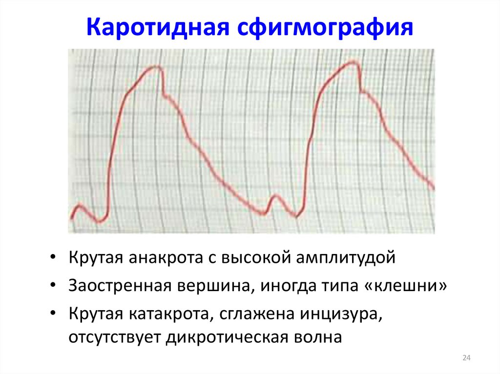 Высокая амплитуда