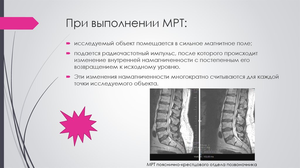 Лучевая диагностика нервной системы презентация