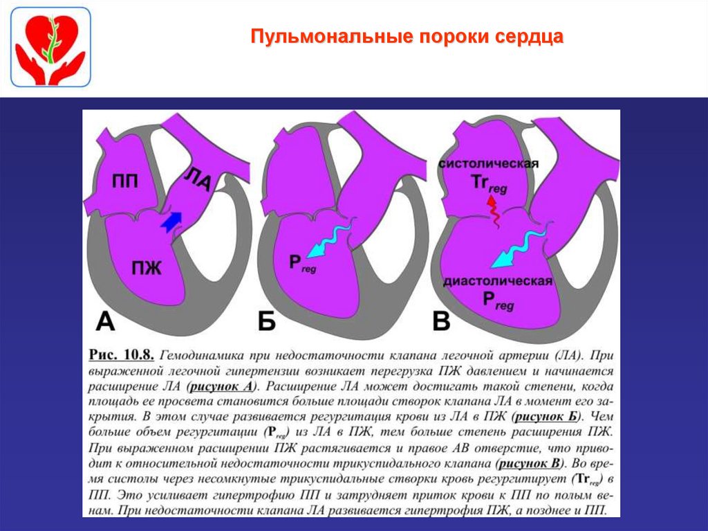 Пороки сердца названия