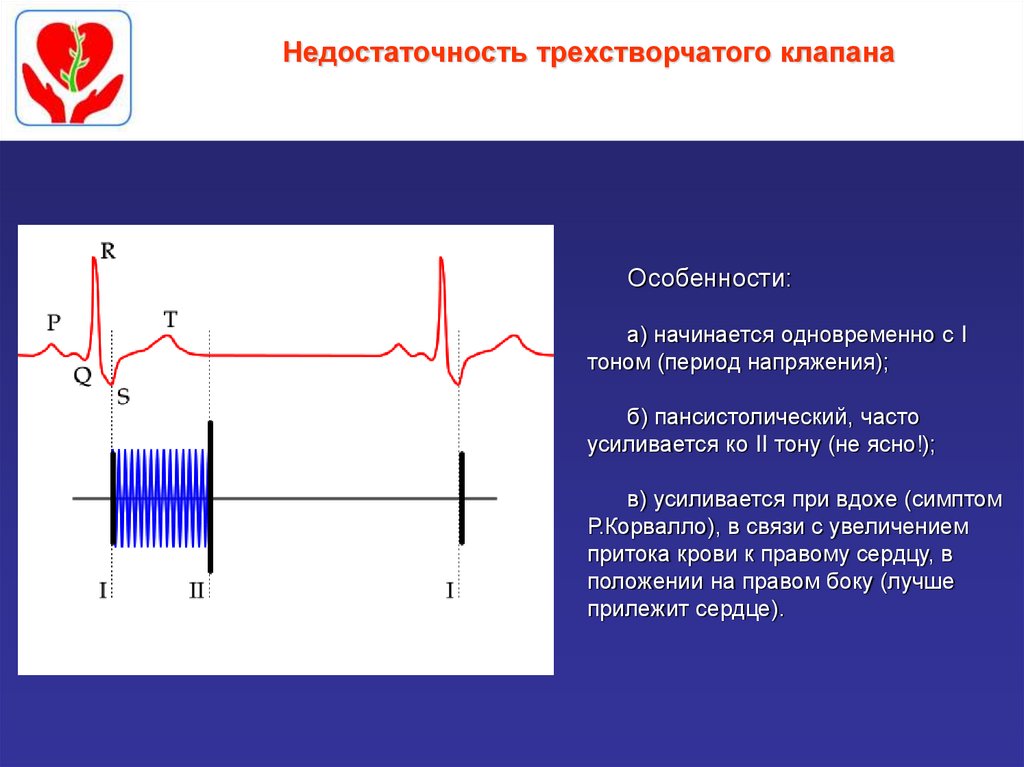 Аускультативная картина сердца у детей имеет следующие особенности