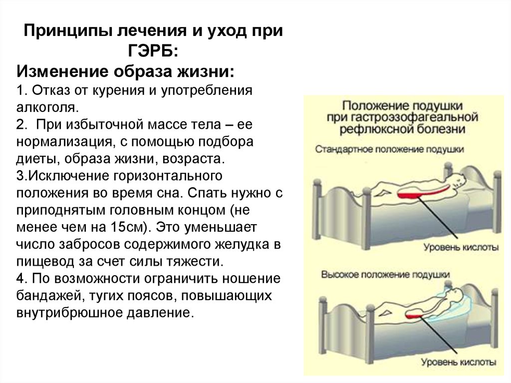 Рефлюксная болезнь презентация