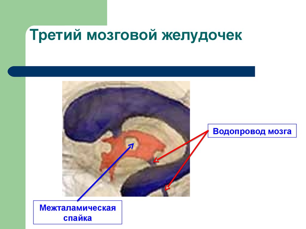 Желудочки среднего мозга. Третий желудочек головного мозга анатомия. Стенки 4 желудочка мозга. 3ий желудочек стенки. Межталамическая спайка.