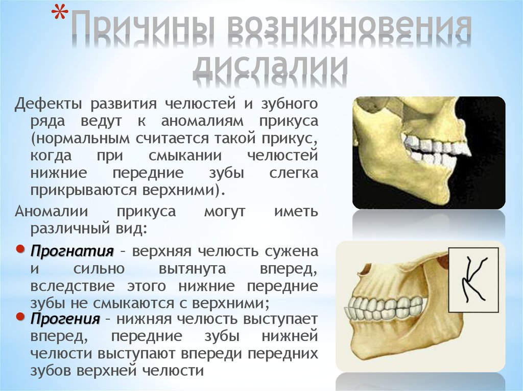 Презентация на тему дислалия - 86 фото