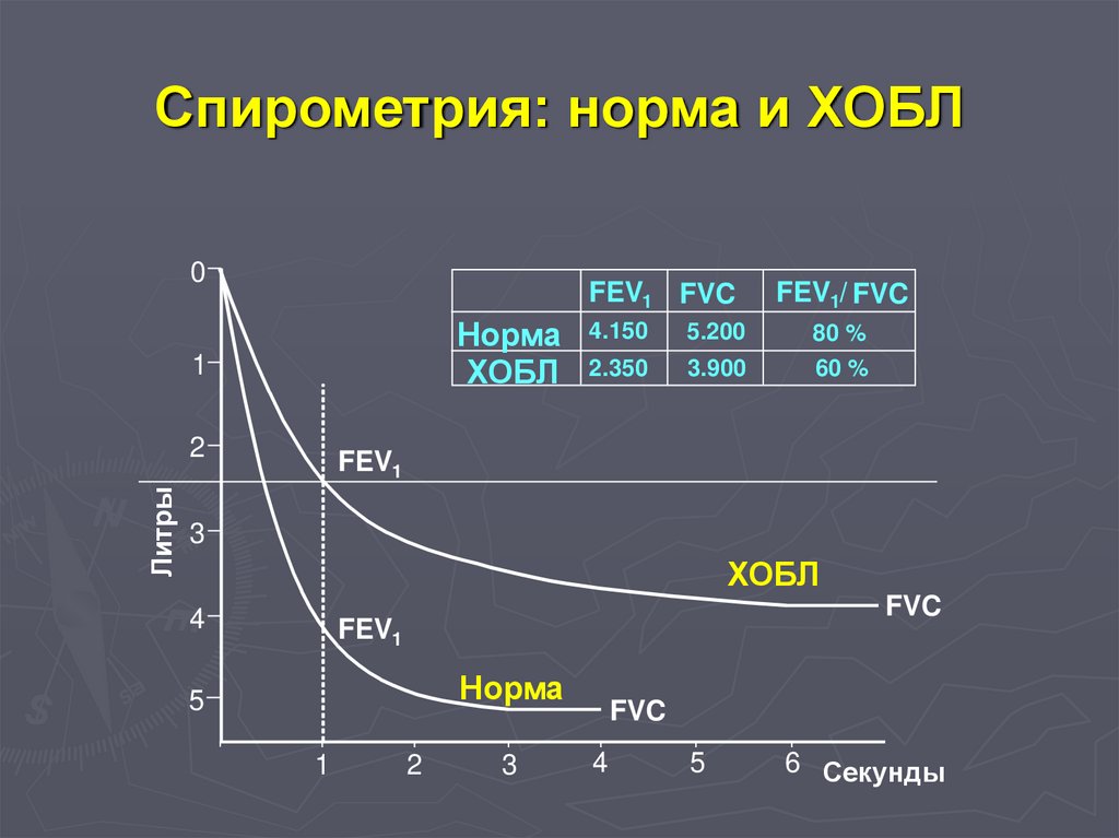 Фвд спирография