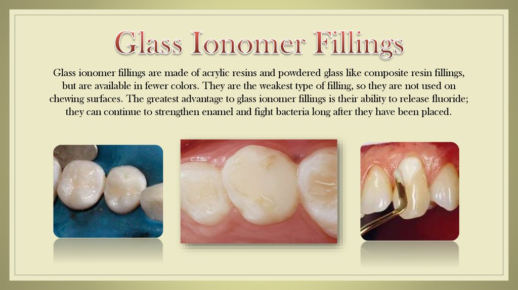 glass tooth filling