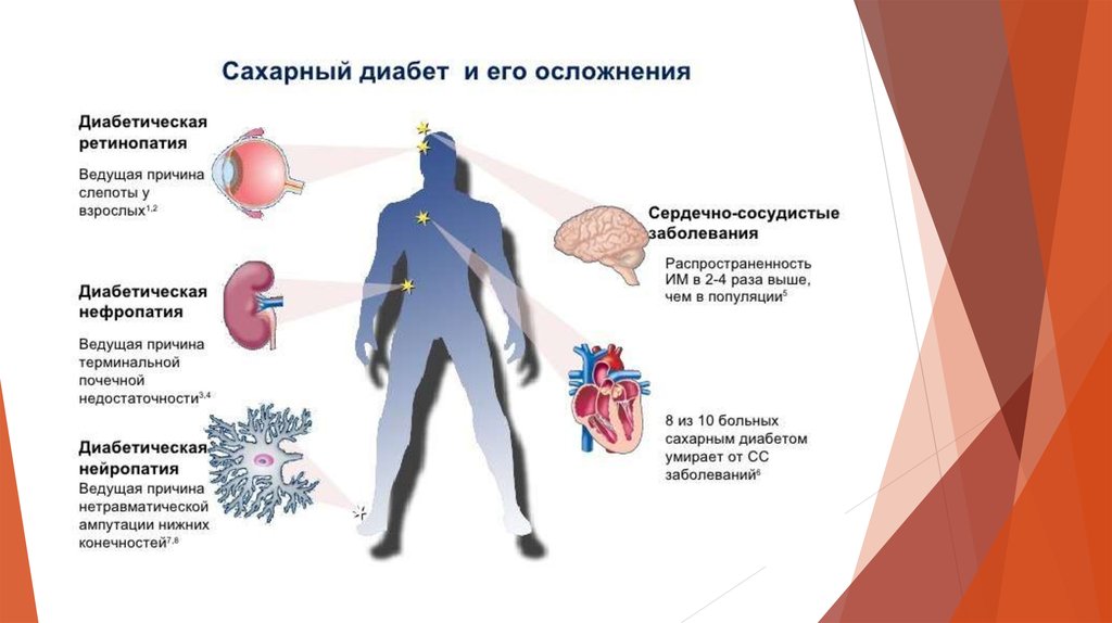 Сахарный диабет 1 презентация