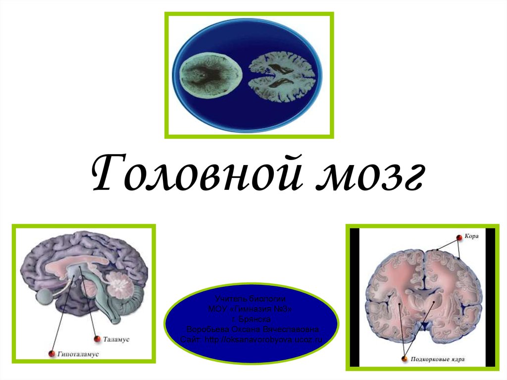 Головной мозг
