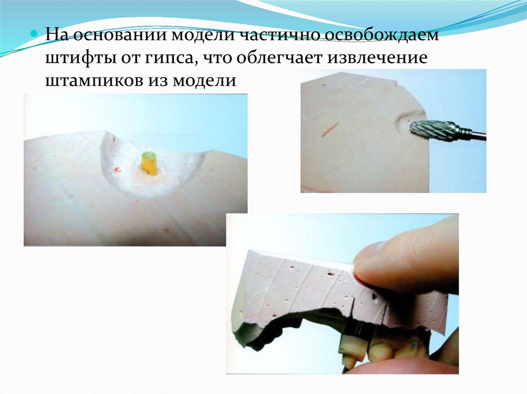 Основание модели. Недостатки металлоакриловых протезов. Извлечение штампика из модели. Недостатки гипса.