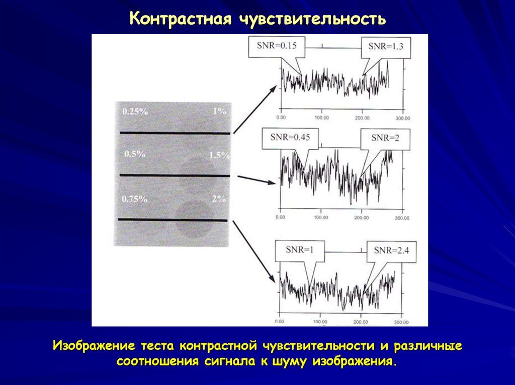 Контрастная чувствительность рентгеновского изображения