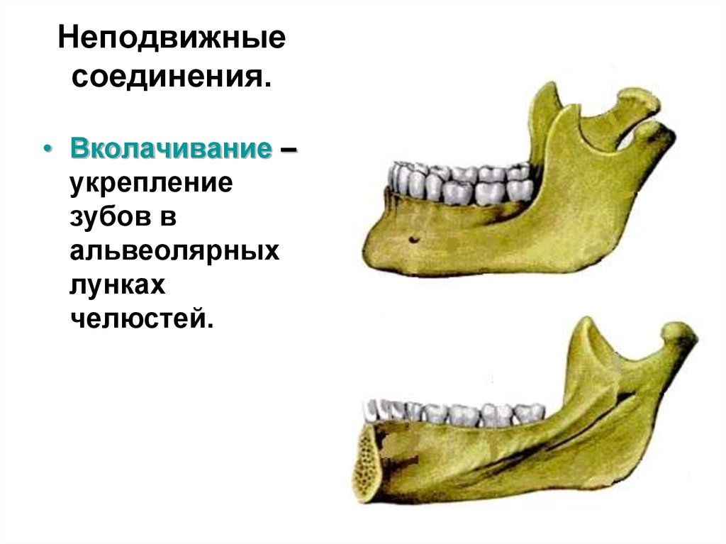 5 неподвижные соединения. Вколачивание соединение костей. Вколачивание зубов соединение костей. Неподвижное соединение. Примеры неподвижных соединений.