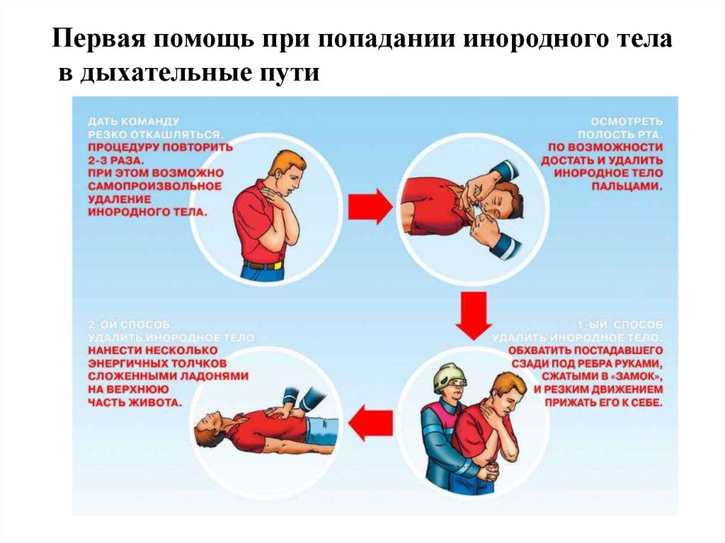 Первая медицинская помощь при удушении презентация