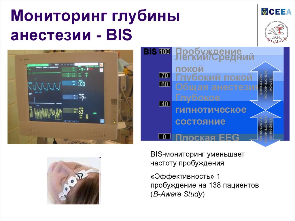 Мониторинг лечения. Монитор глубины анестезии bis. Мониторинг глубины анестезии. Bis мониторинг в анестезиологии. Бис мониторинг глубины наркоза.