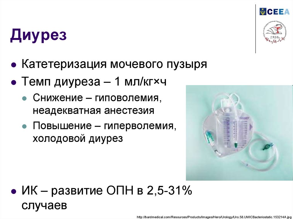 1 диурез. Измерение диуреза. Контроль почасового диуреза. Холодовой диурез. Система для контроля почасового диуреза.