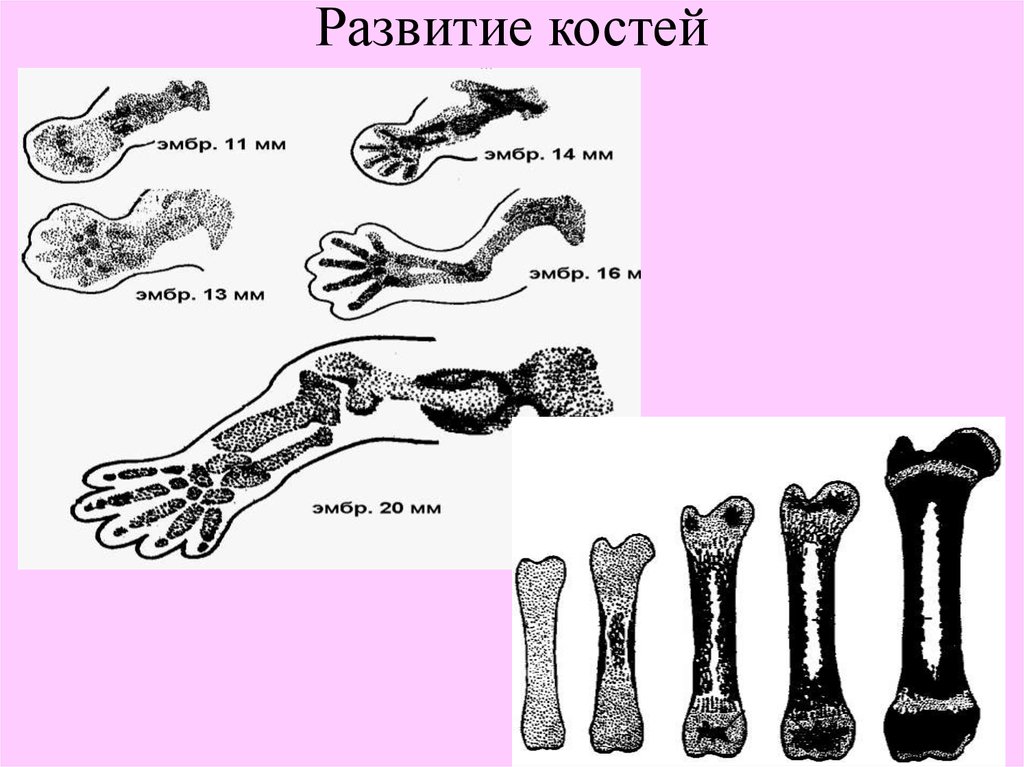 Формирование костей. Развитие костей. Формирование кости. Аномалии развития костей человека.