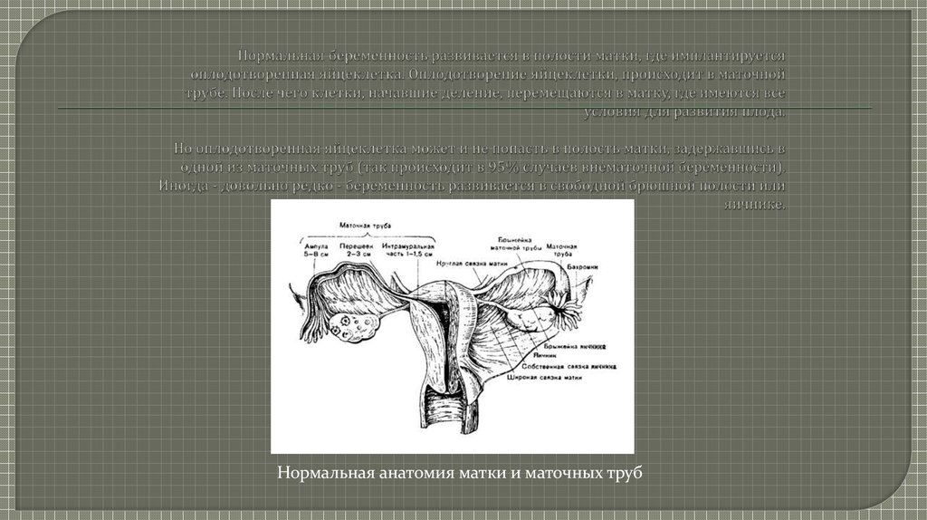Оплодотворение в полости матки. Матка анатомия. Полость матки анатомия. Маточные трубы кт анатомия.