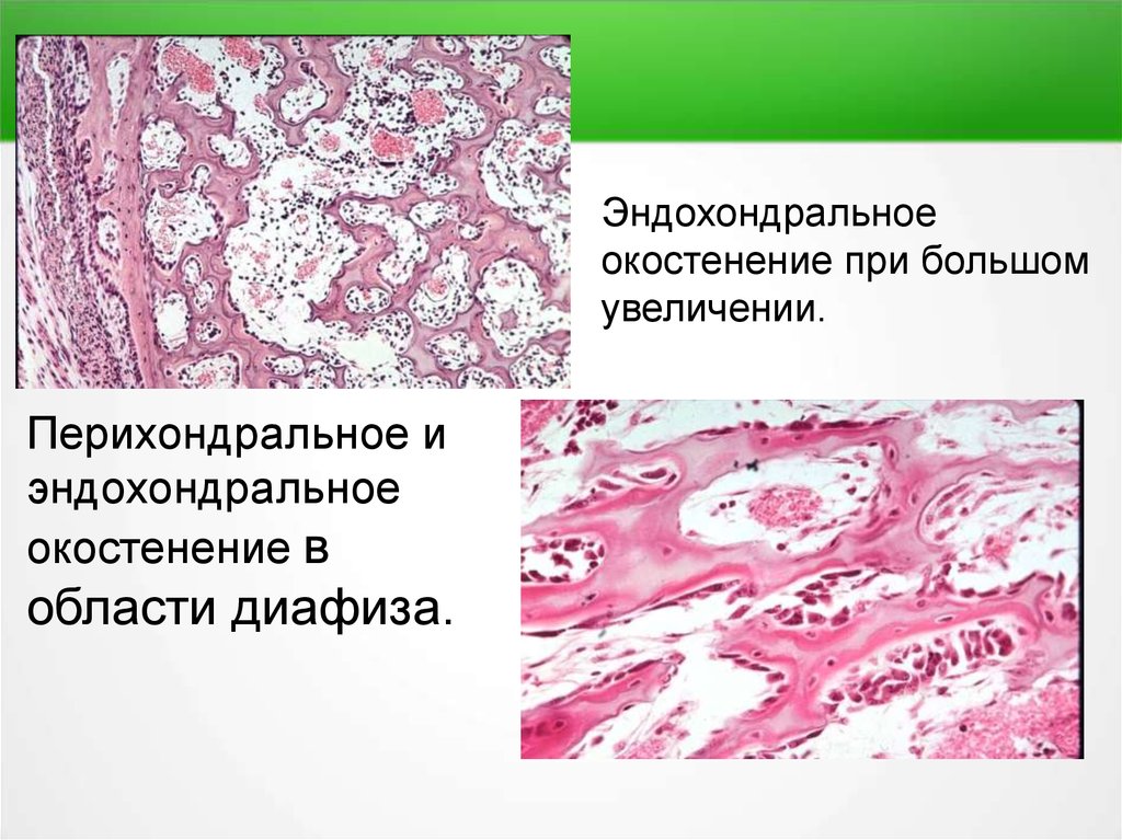 Схема непрямого остеогенеза гистология