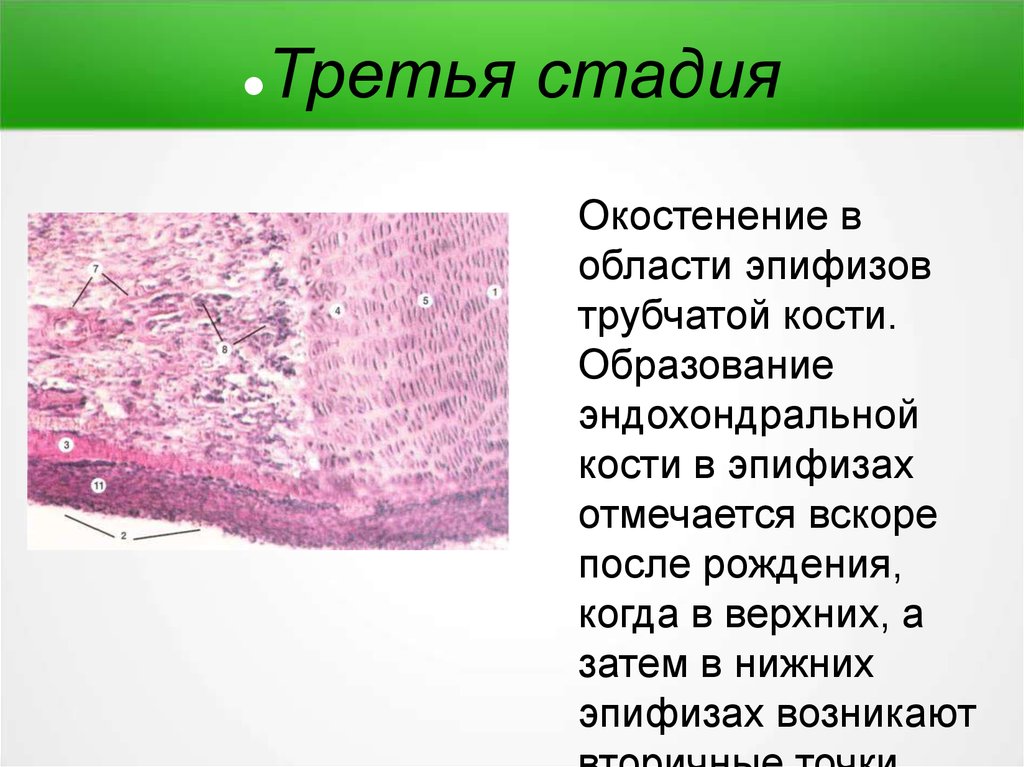 Репаративный остеогенез презентация