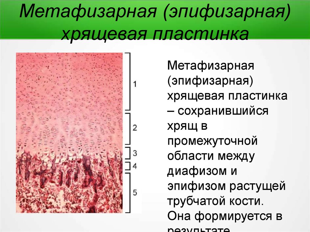 Непрямой остеогенез. Гистология эпифизарной пластинки.