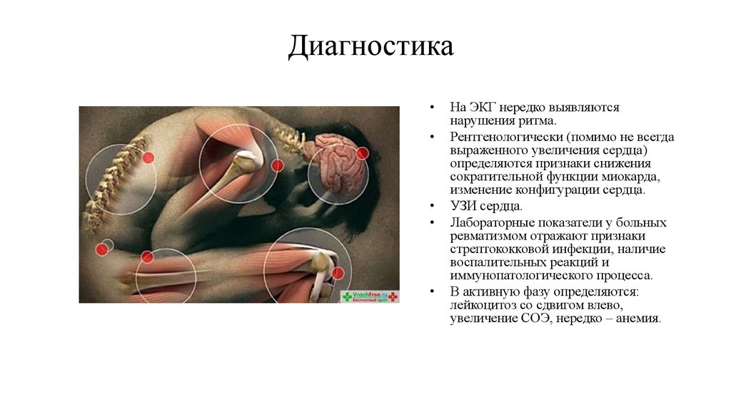 Курсовая работа по теме Распространенность ревматоидного артрита среди населения Ошской области