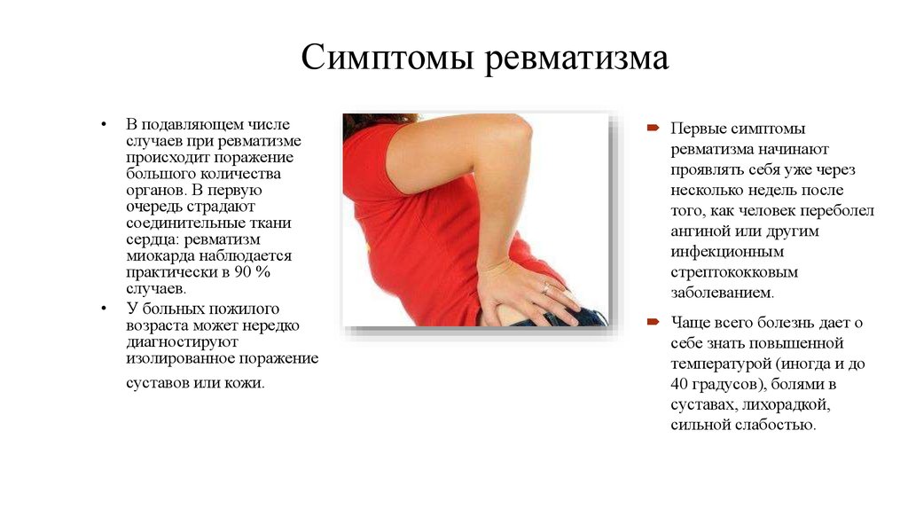 Ревматизм симптомы у женщин лечение