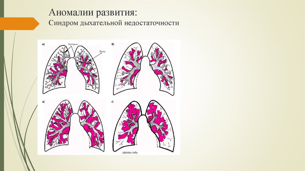 Острая дыхательная недостаточность картинки для презентации