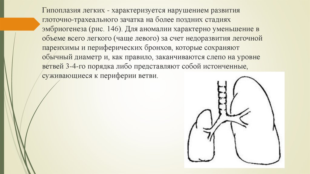 Врожденные пороки развития дыхательной системы презентация