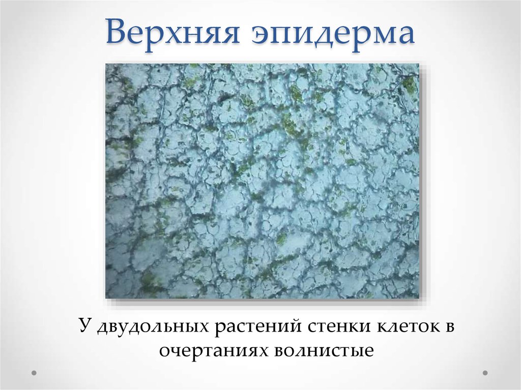 Эпидерма. Верхняя эпидерма. Верхний слой эпидермы. Верхний слой эпидермы листа. Верхний слой эпидермы на рисунке.