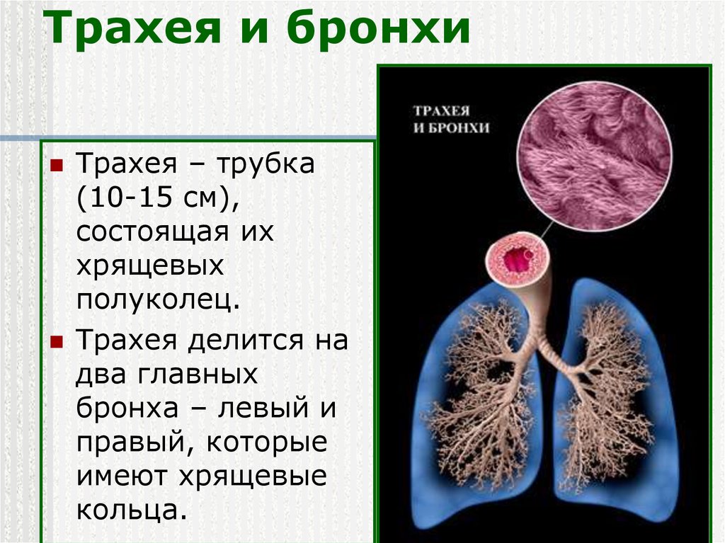 Бронхи и трахеи на картинке