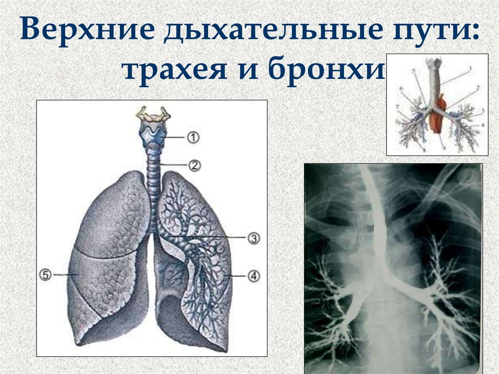 Трахеи бронхи легкие. Бронхи и трахея это дыхательные пути. Верхние воздухоносные пути. Нижние дыхательные пути трахея бронхи. Верхние бронхи.