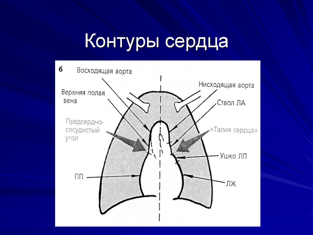 Карта сердце как называется