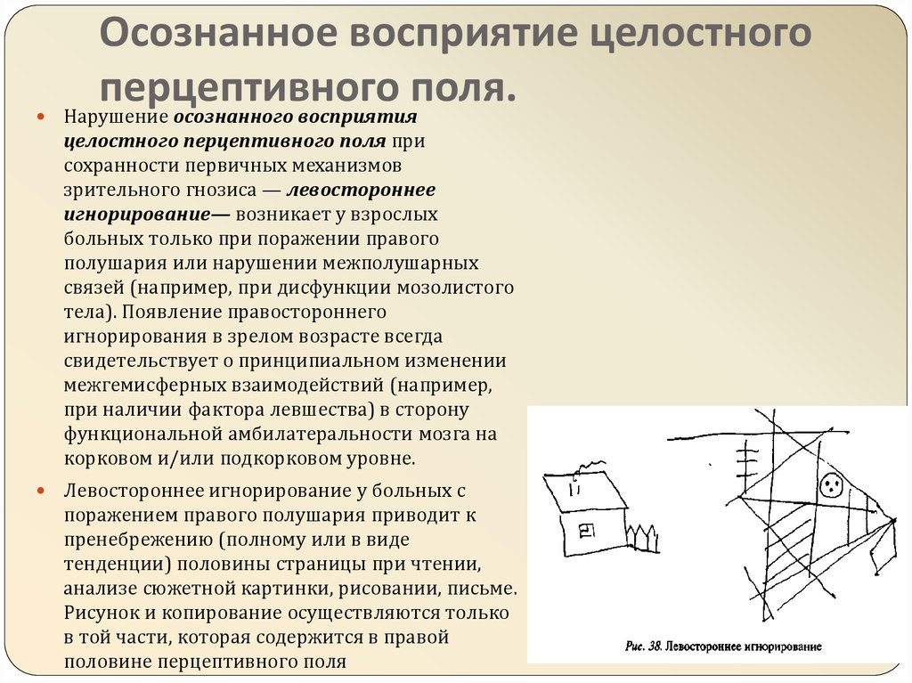 Нарушения пространственных представлений