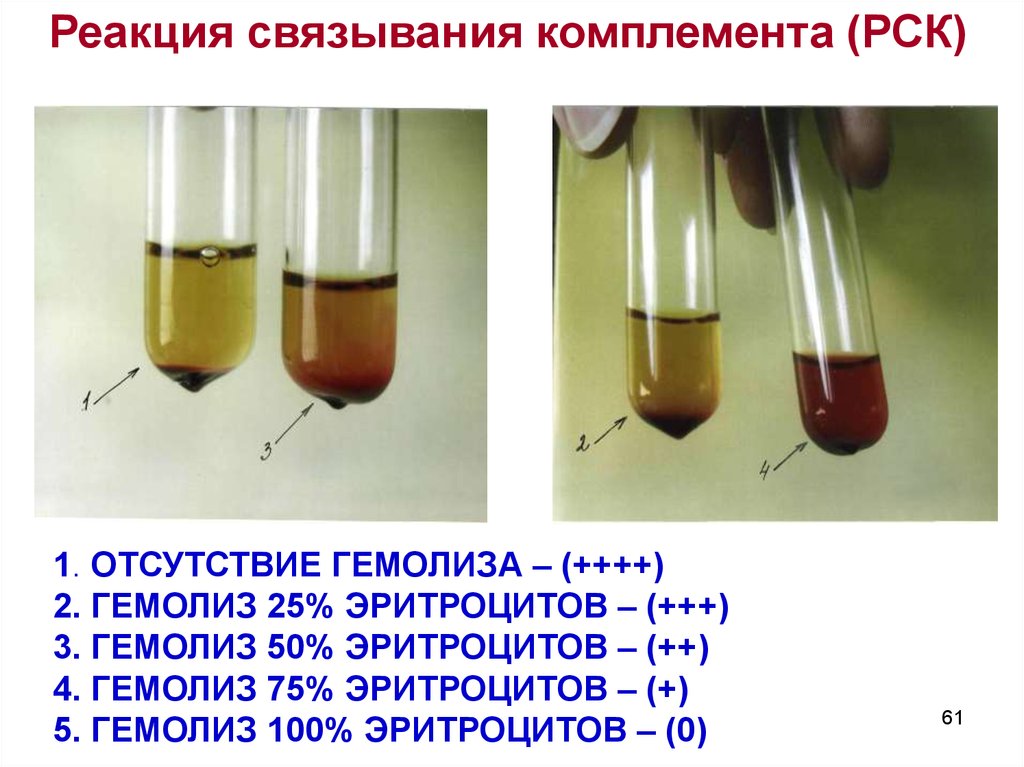 Схема постановки реакции связывания комплемента