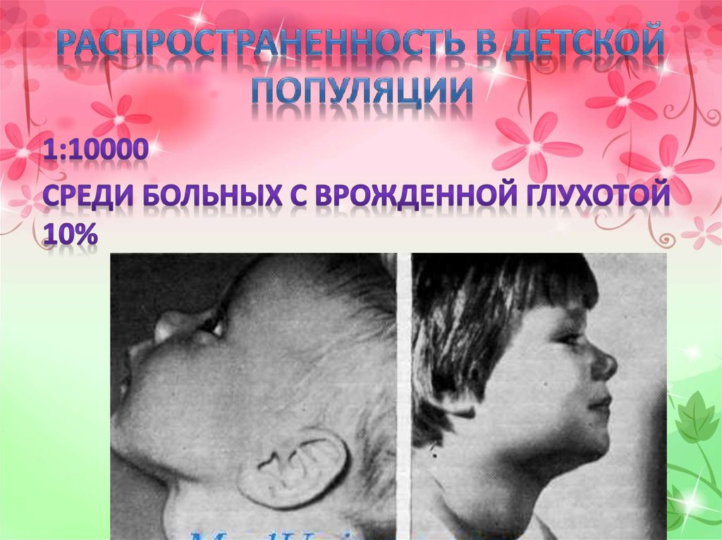 Синдром Пендреда - презентация онлайн