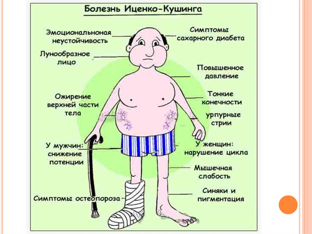 Болезнь кушинга. Клинические симптомы болезни Иценко-Кушинга. Клинические проявления болезни Иценко Кушинга. Иценко -Кушинга ожирение. Факторы риска болезни Иценко Кушинга.