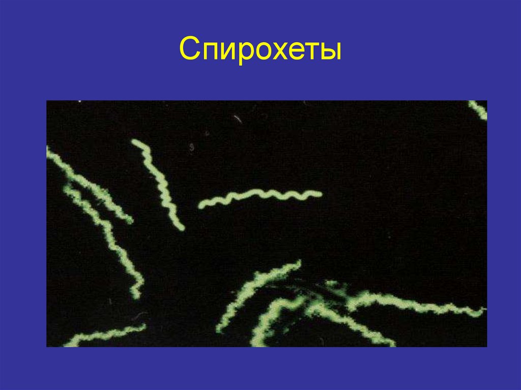 Спирохеты. Спирохеты трепонемы боррелии лептоспиры. Трепонема боррелия лептоспира. Бледная спирохета микробиология. Спирохеты полости рта Treponema.