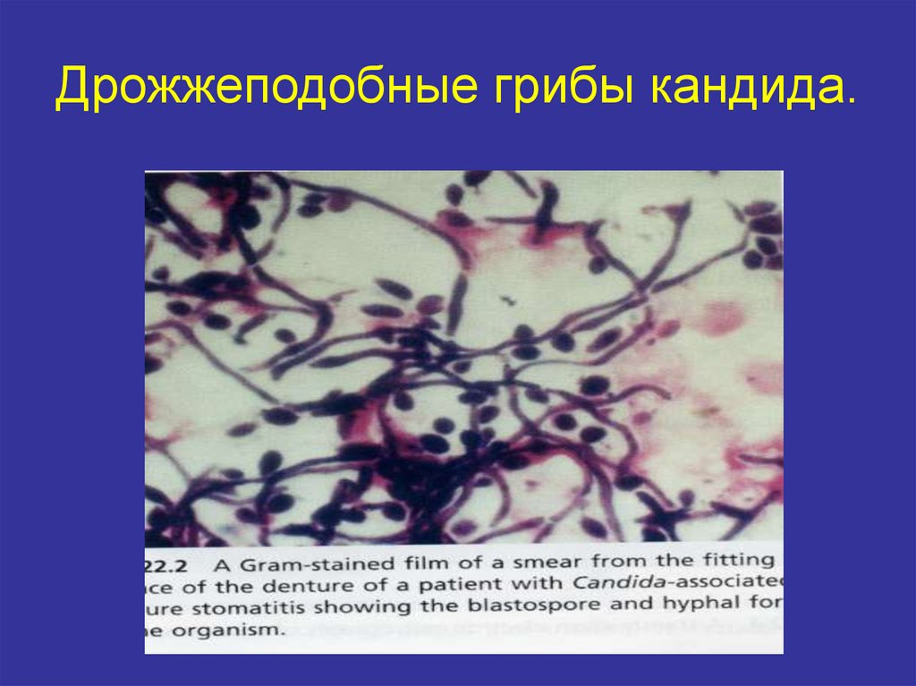 Грибы candida. Дрожжеподобные грибы рода Candida. Дрожжеподобные грибки рода Candida форма. Candida albicans окраска по Граму. Кандида мазок по Граму.