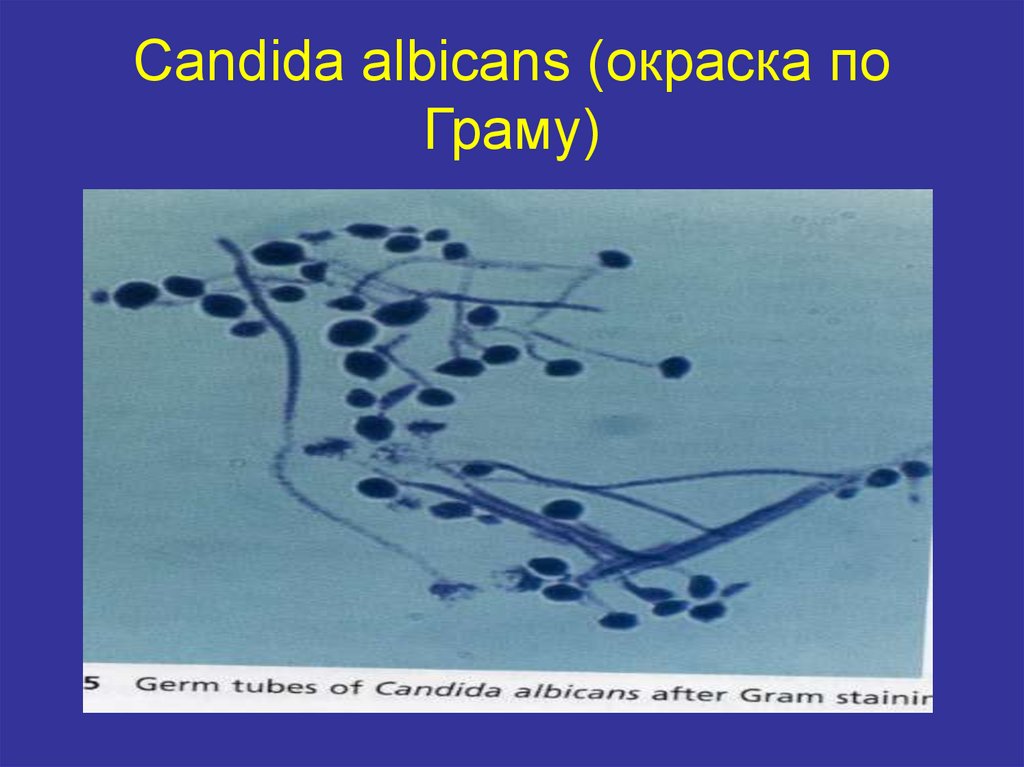 Candida albicans. Окрашивание по Граму грибы кандида. Морфология колоний Candida albicans. Candida albicans по Граму. Candida albicans чистая культура.