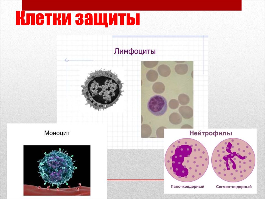 Защитная клетка