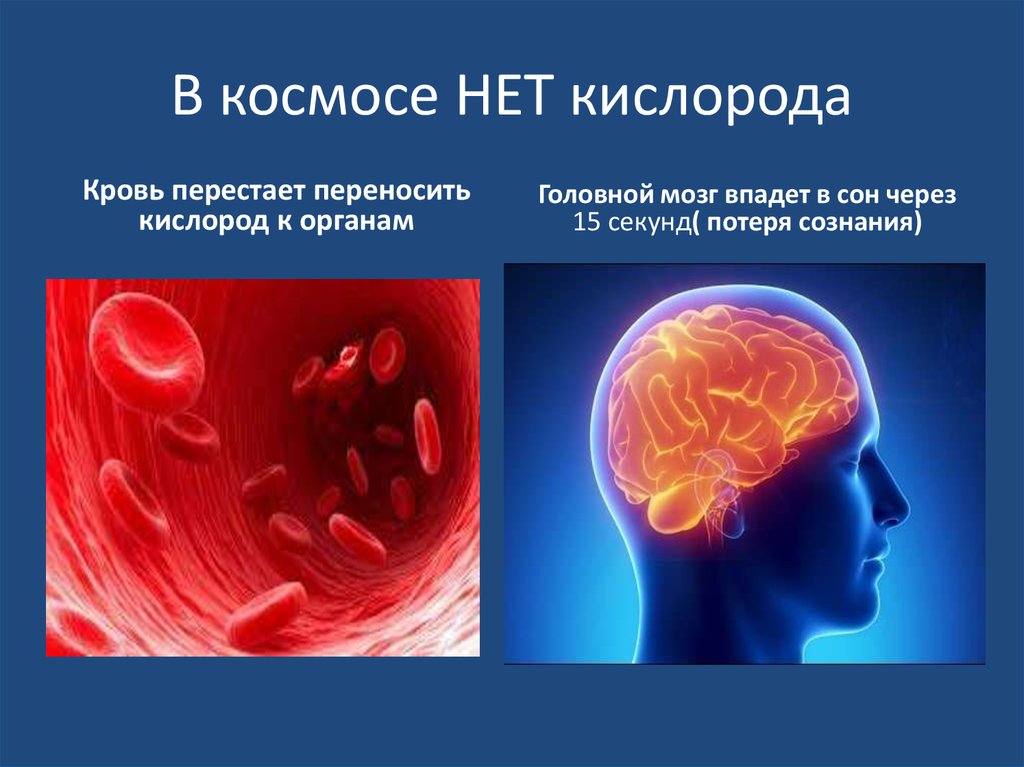 Мозг человека без кислорода