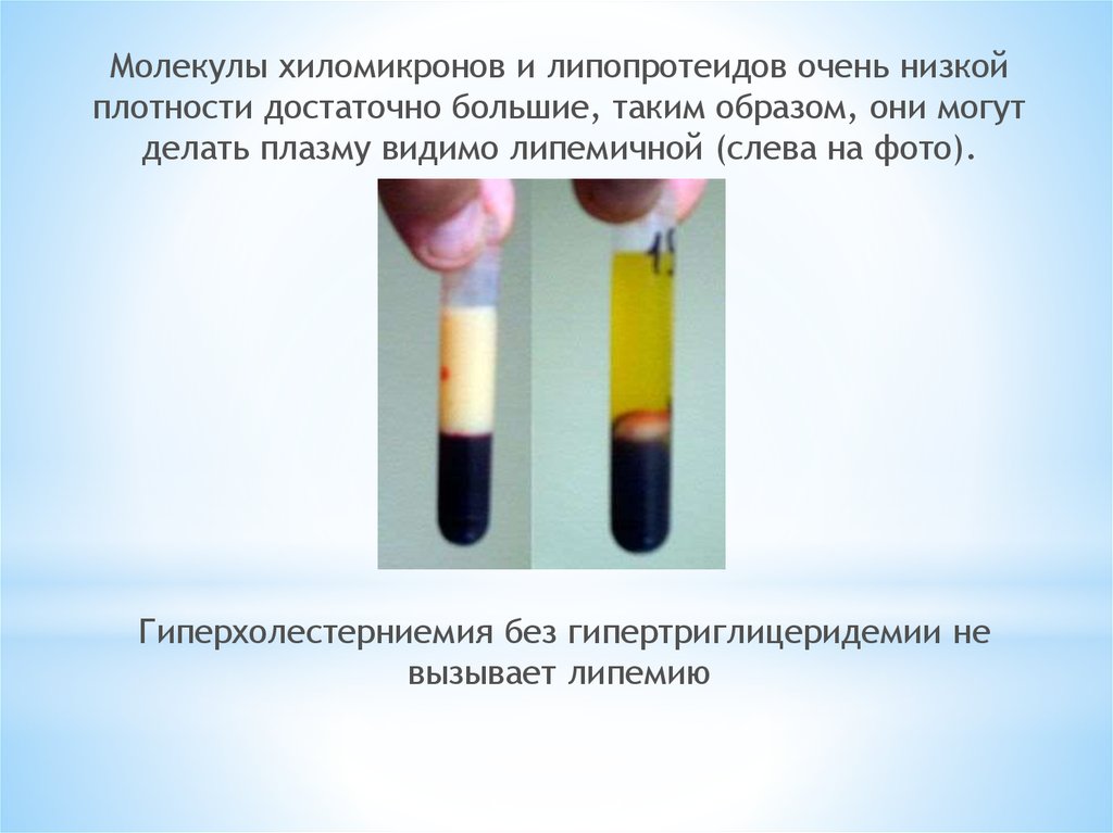 Определение степени липемии иктеричности и гемолиза образца