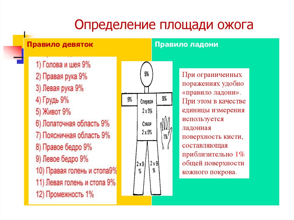 Правила определения площади ожогов