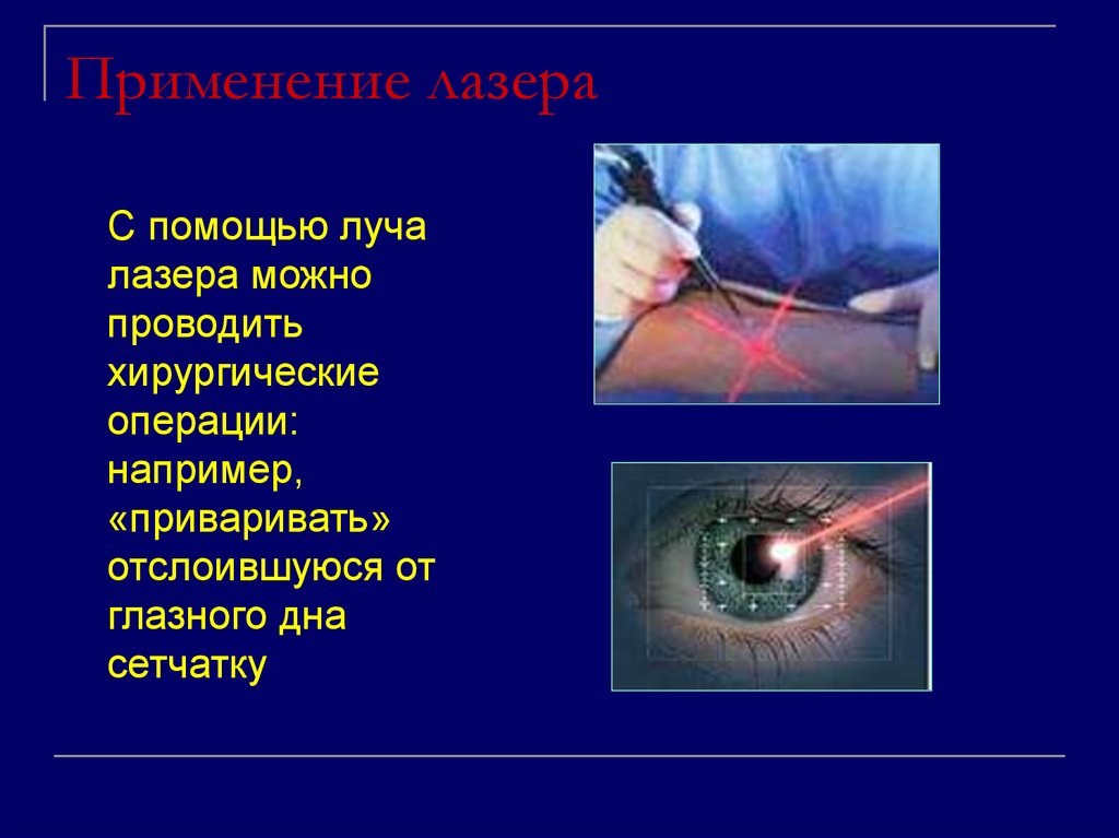 Применение лазера в медицине презентация по физике