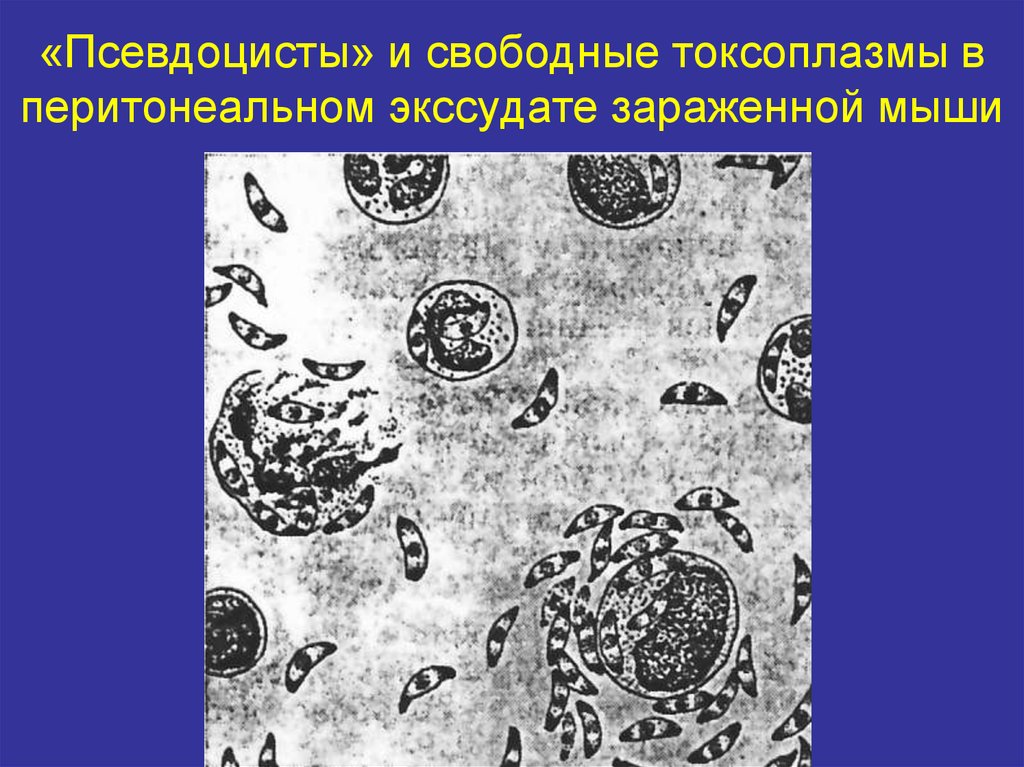 «Псевдоцисты» и свободные токсоплазмы в перитонеальном экссудате зараженной мыши
