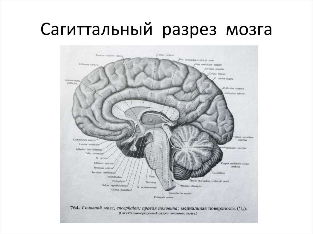 Сагиттальный разрез мозга. Срединный Сагиттальный срез головного мозга. Сагиттальный разрез головного мозга борозды. Головной мозг Сагиттальный разрез атлас. Строение головного мозга Сагиттальный срез.