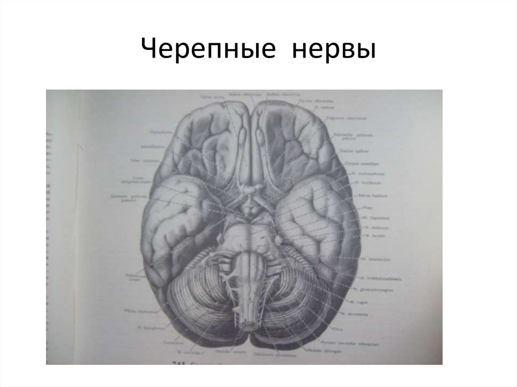 5 6 черепные нервы. Черепные нервы на мозге. Шулешова н.в. "Черепные нервы". 6-8 Черепные нервы головной мозг человека. 12 Черепных нервов учебник.