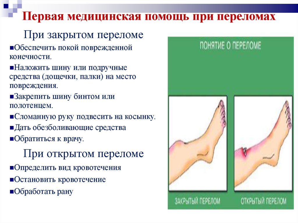 Первая медицинская помощь при травмах виды травм