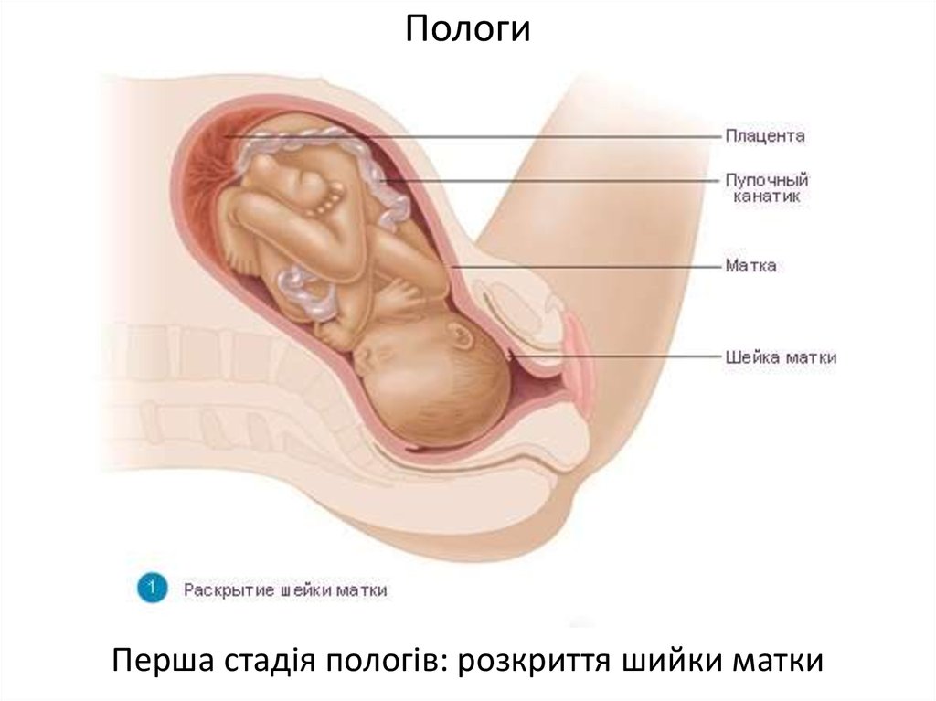 Родами шейка. Раскрытие шейки матки. Шейка матки перед родами. Раскрытая шейка перед родами.